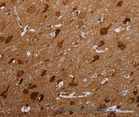 Immunohistochemistry of paraffin-embedded Human brain tissue using MAGEC2 Polyclonal Antibody at dilution 1:40