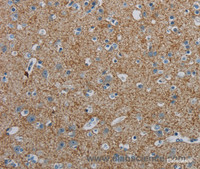 Immunohistochemistry of paraffin-embedded Human brain tissue using PGLYRP1 Polyclonal Antibody at dilution 1:40