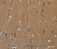 Immunohistochemistry of paraffin-embedded Human brain tissue using PIK3CG Polyclonal Antibody at dilution 1:50