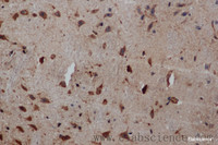 Immunohistochemistry of paraffin-embedded Human brain tissue using PIK3CB Polyclonal Antibody at dilution 1:50