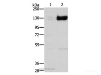 Western Blot analysis of Untreated and treated with cobalt chloride (0.1 mM for 4 hours) of 293T cell using HIF1 alpha Polyclonal Antibody at dilution of 1:750