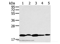 Western Blot analysis of K562, 231, Jurkat, hela and 293T cell using RNF5 Polyclonal Antibody at dilution of 1:200