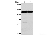 Western Blot analysis of Mouse heart and muscle tissue using ACTN2 Polyclonal Antibody at dilution of 1:200