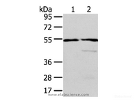 Western Blot analysis of Human normal liver and fetal liver tissue using ALDH3A2 Polyclonal Antibody at dilution of 1/250