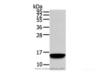 Western Blot analysis of Human normal prostate tissue using VAMP5 Polyclonal Antibody at dilution of 1/650