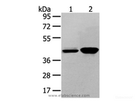 Western Blot analysis of Hela and 293T cell using VASH2 Polyclonal Antibody at dilution of 1/450