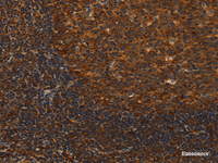 Immunohistochemistry of paraffin-embedded Human tonsil tissue using MIP Polyclonal Antibody at dilution 1:40