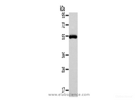 Western Blot analysis of Human normal liver tissue using FOXC1 Polyclonal Antibody at dilution of 1/400