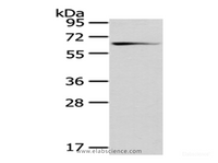 Western Blot analysis of Mouse brain tissue using GAD1 Polyclonal Antibody at dilution of 1/200