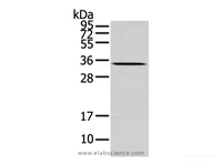 Western Blot analysis of Mouse liver tissue using UCP2 Polyclonal Antibody at dilution of 1/200