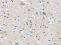 Immunohistochemistry of paraffin-embedded Human brain using VGF Polyclonal Antibody at dilution of 1/45