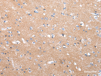 Immunohistochemistry of paraffin-embedded Human brain tissue using COLEC12 Polyclonal Antibody at dilution 1:40