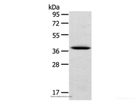 Western Blot analysis of Human cervical cancer tissue using TPM2 Polyclonal Antibody at dilution of 1:750