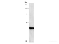 Western Blot analysis of Hela cell using Proliferating Cell Nuclear Antigen Polyclonal Antibody at dilution of 1:500