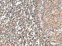 Immunohistochemistry of paraffin-embedded Human tonsil tissue using CHKA Polyclonal Antibody at dilution of 1:35 (×200)