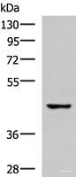 Western blot analysis of 293T cell lysate using TNFRSF10D Polyclonal Antibody at dilution of 1:500