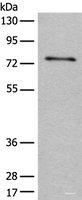 Western blot analysis of Human hepatocellular carcinoma 2 tissue lysate using ADGRE3 Polyclonal Antibody at dilution of 1:400