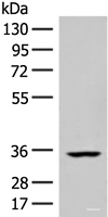 Western blot analysis of Human heart tissue lysate using FBXO16 Polyclonal Antibody at dilution of 1:400