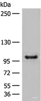 Western blot analysis of HEPG2 cell lysate using CTDP1 Polyclonal Antibody at dilution of 1:500