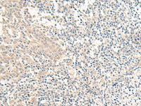 Immunohistochemistry of paraffin-embedded Human tonsil tissue using GPR161 Polyclonal Antibody at dilution of 1:40 (×200)