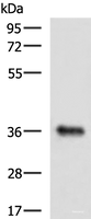 Western blot analysis of Mouse liver tissue lysate using GRHPR Polyclonal Antibody at dilution of 1:900