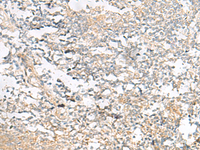 Immunohistochemistry of paraffin-embedded Human tonsil tissue using HELT Polyclonal Antibody at dilution of 1:40 (×200)