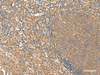 Immunohistochemistry of paraffin-embedded Human tonsil tissue using HTT Polyclonal Antibody at dilution of 1:25 (×200)