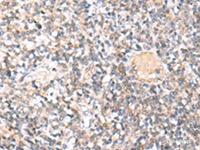 Immunohistochemistry of paraffin-embedded Human tonsil tissue using IL36A Polyclonal Antibody at dilution of 1:30 (×200)