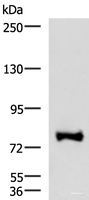 Western blot analysis of TM4 cell lysate using FOXK2 Polyclonal Antibody at dilution of 1:1000