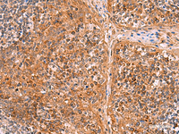 Immunohistochemistry of paraffin-embedded Human tonsil tissue using CREBBP Polyclonal Antibody at dilution of 1:35 (×200)