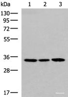 Western blot analysis of 293T and HepG2 cell lysates using SOX2 Polyclonal Antibody at dilution of 1:800