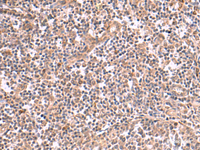 Immunohistochemistry of paraffin-embedded Human tonsil tissue using SLC12A7 Polyclonal Antibody at dilution of 1:50 (×200)