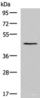 Western blot analysis of TM4 cell lysate using KCNK18 Polyclonal Antibody at dilution of 1:800