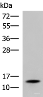 Western blot analysis of Mouse serum using TTR Polyclonal Antibody at dilution of 1:600