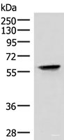Western blot analysis of Hela cell lysate using VIM Polyclonal Antibody at dilution of 1:4000