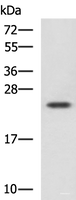 Western blot analysis of Jurkat cell lysate using CBX5 Polyclonal Antibody at dilution of 1:1100