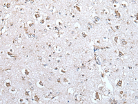 Immunohistochemistry of paraffin-embedded Human brain tissue using MCM10 Polyclonal Antibody at dilution of 1:45 (×200)