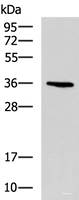 Western blot analysis of A549 cell lysate using BDNF Polyclonal Antibody at dilution of 1:900