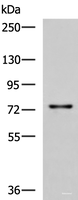 Western blot analysis of Rat liver tissue lysate using TGFBI Polyclonal Antibody at dilution of 1:850