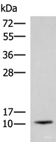 Western blot analysis of Human fetal brain tissue lysate using ACYP1 Polyclonal Antibody at dilution of 1:700