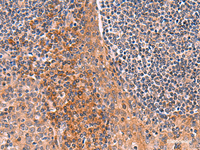 Immunohistochemistry of paraffin-embedded Human tonsil tissue using ACYP1 Polyclonal Antibody at dilution of 1:65 (×200)