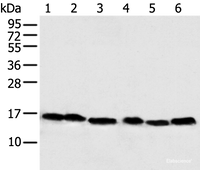 Western blot analysis of 293T Hela PC-3 Lncap and 231 cell Human fetal muscle tissue using NDUFB6 Polyclonal Antibody at dilution of 1:500