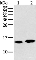 Western blot analysis of Rat heart tissue and Mouse brain tissue using CARTPT Polyclonal Antibody at dilution of 1:350