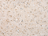 Immunohistochemistry of paraffin-embedded Human brain tissue using NUDT10 Polyclonal Antibody at dilution of 1:70 (×200)