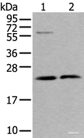 Western blot analysis of LO2 cell and Human testis tissue lysates using ABHD14B Polyclonal Antibody at dilution of 1:350
