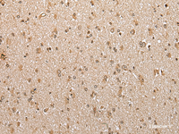 Immunohistochemistry of paraffin-embedded Human brain tissue using ABHD14B Polyclonal Antibody at dilution of 1:30 (×200)