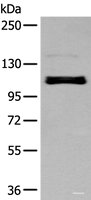 Western blot analysis of A549 cell using ZNF281 Polyclonal Antibody at dilution of 1:250
