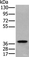 Western blot analysis of Human testis tissue lysate using ZPBP Polyclonal Antibody at dilution of 1:250