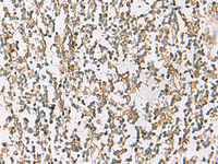 Immunohistochemistry of paraffin-embedded Human tonsil tissue using ZPBP2 Polyclonal Antibody at dilution of 1:80 (×200)