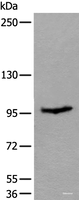 Western blot analysis of Mouse skeletal muscle tissue lysate using UNC45B Polyclonal Antibody at dilution of 1:600